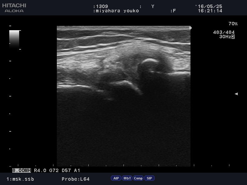 http://maru84.com/update/up-img/lateral%20collateral%20ligament.JPG