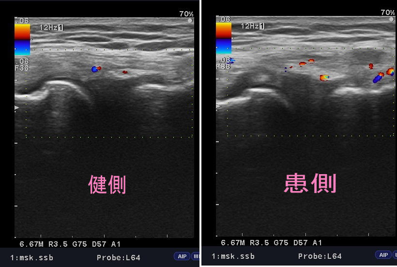 http://maru84.com/update/up-img/lateral%20collateral%20ligament.jpg
