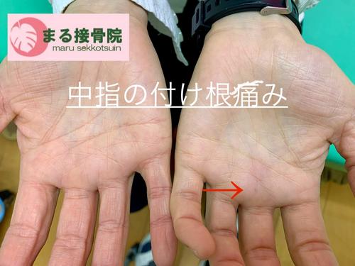 中指の付け根の痛み.JPG