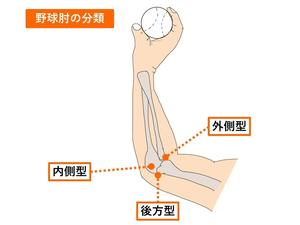 野球肘.jpg