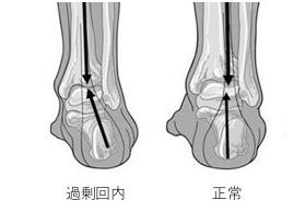 足の 内くるぶし の下の痛み 更新情報 まる接骨院