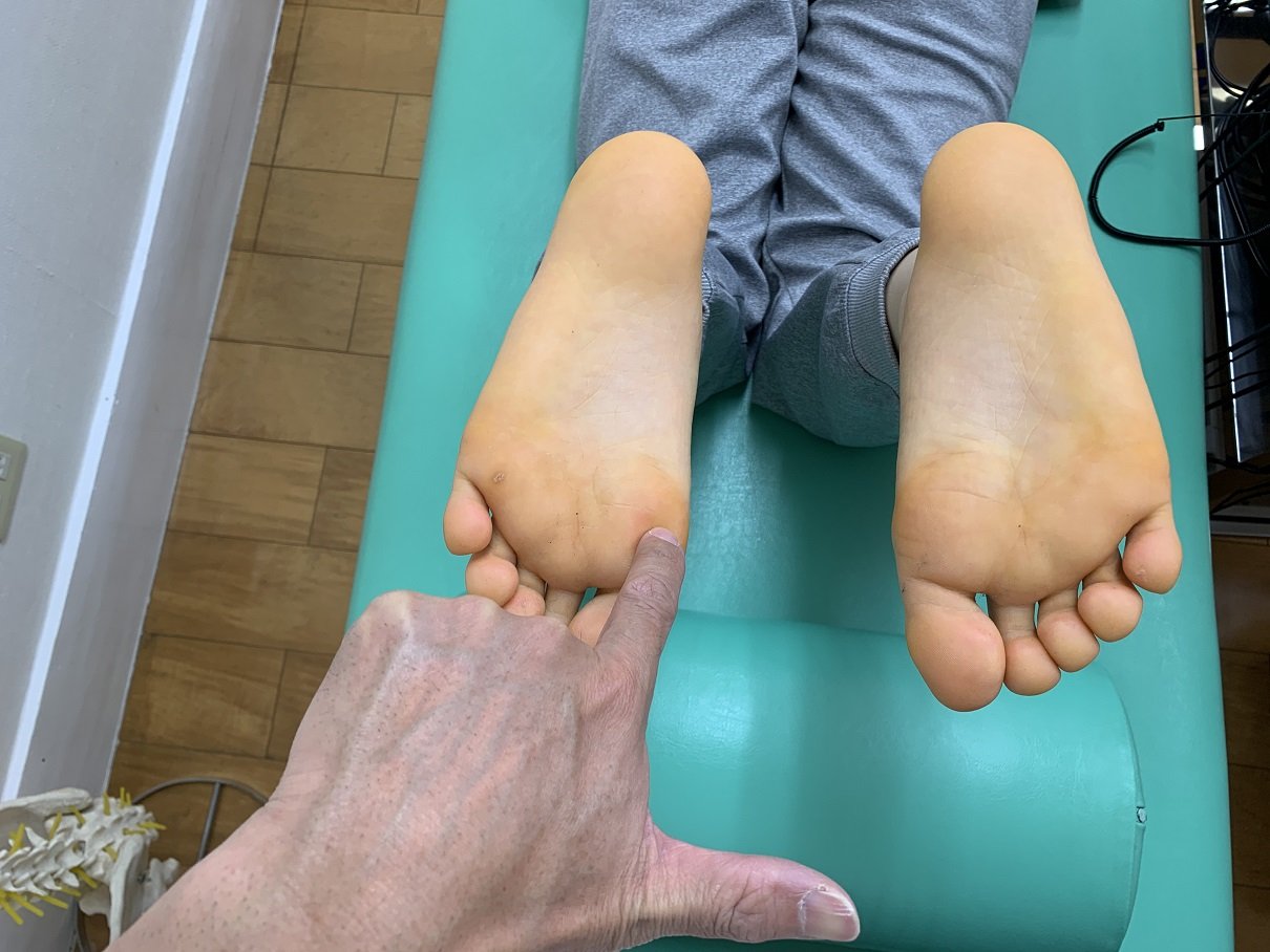足の親指の付け根の痛み