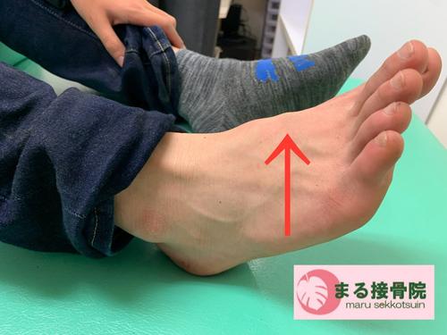 足の甲の痛み.JPG