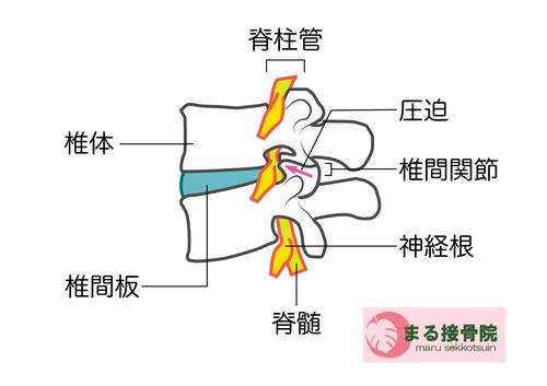 まる接骨院椎間関節.JPG