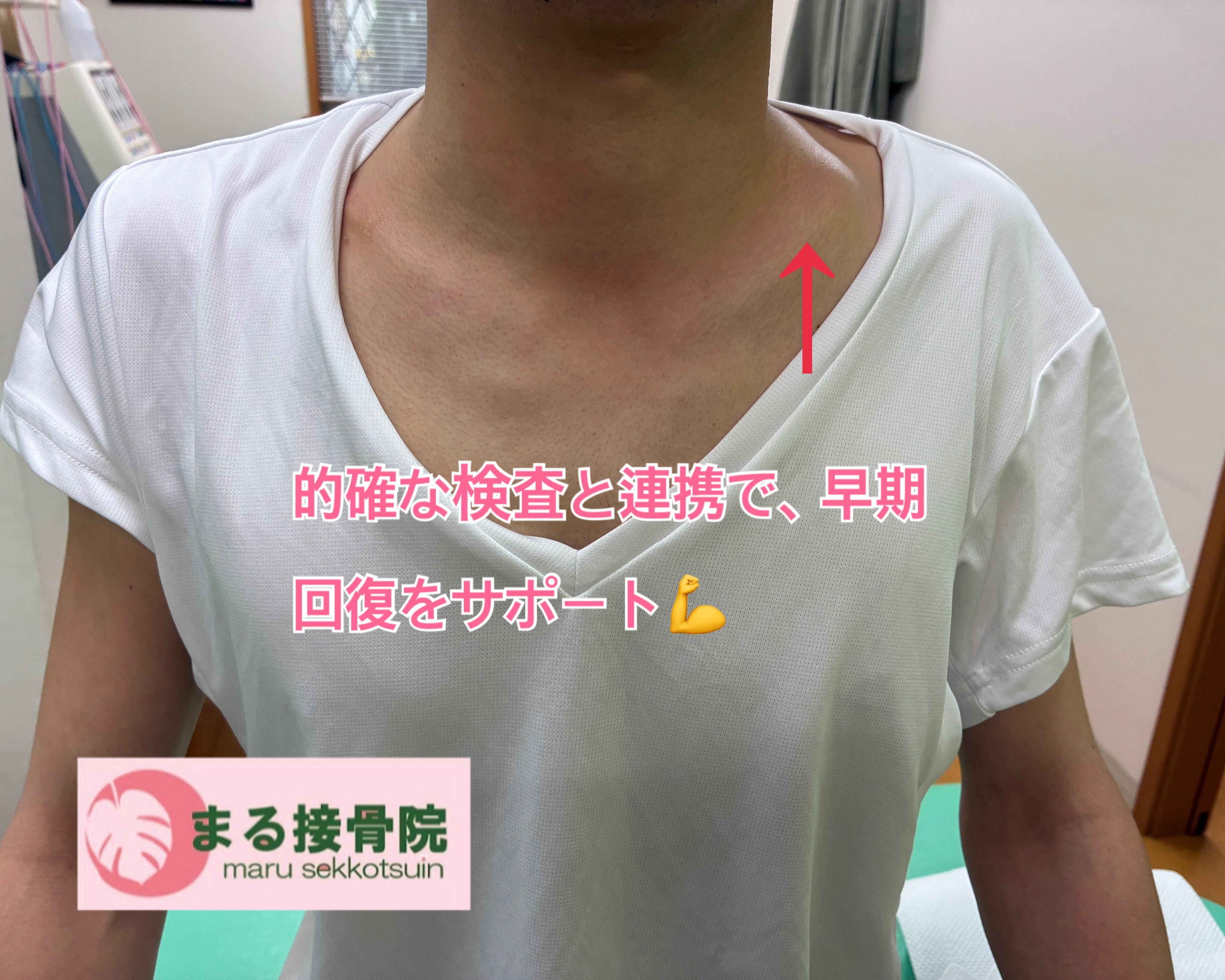 雨の日の転倒で「鎖骨骨折」--バイク事故でのご来院例
