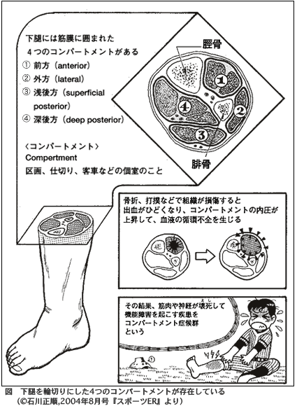 ふくらはぎの肉離れ 更新情報 まる接骨院
